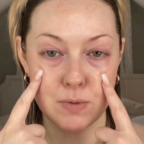 Oogstrakkende Crème